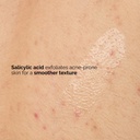 The Ordinary Salicylic Acid 0.5% Body Serum, Exfoliating Treatment for Acne-Prone Skin, 8.1 Fl Oz Brand.